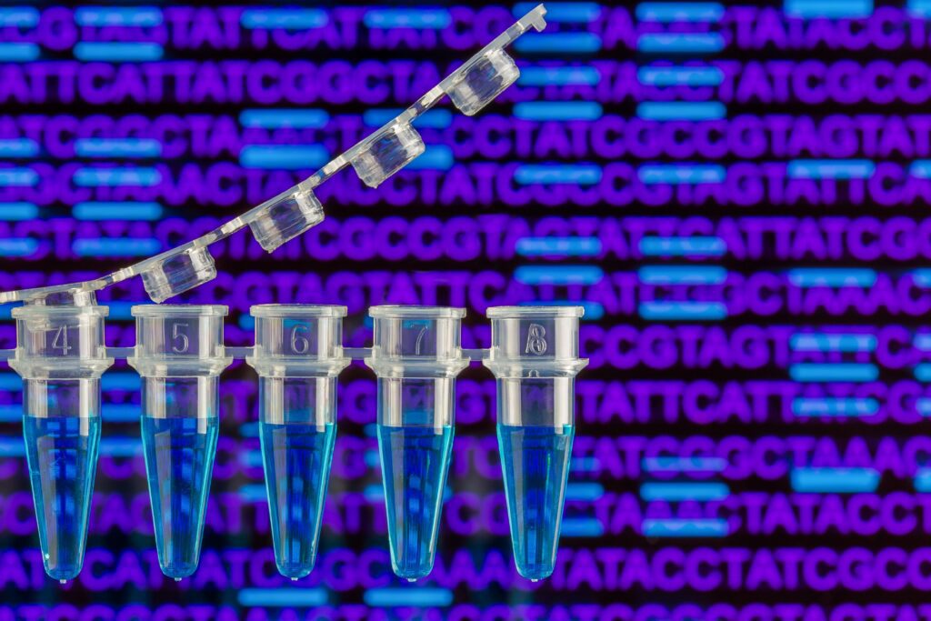 Campioni di PCR con sequenza di DNA e bande sullo sfondo.